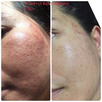 Organic Thai-made skincare featuring moringa oil and natural ingredients for real results