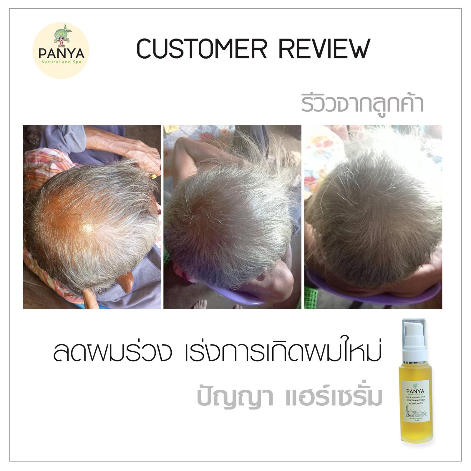 Before and after using Panya Hair Serum, showing thicker and healthier-looking hair.